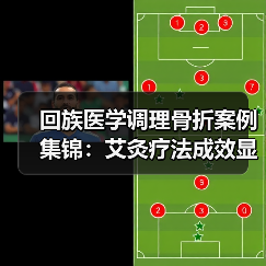 回族医学调理骨折案例集锦：艾灸疗法成效显著（图2）