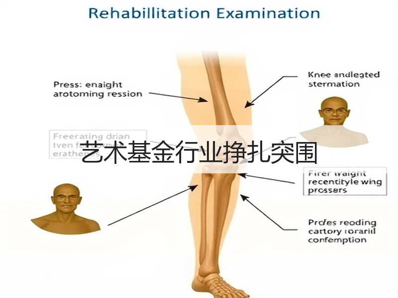 艺术基金行业挣扎突围